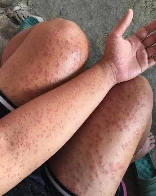 These are the consequences of sleeping with…See more