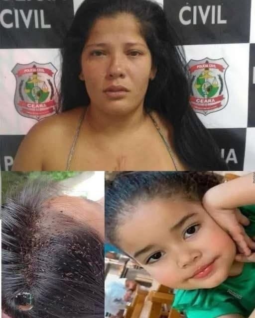 3-year-old girl d!es after lice attack and mother warns… See More