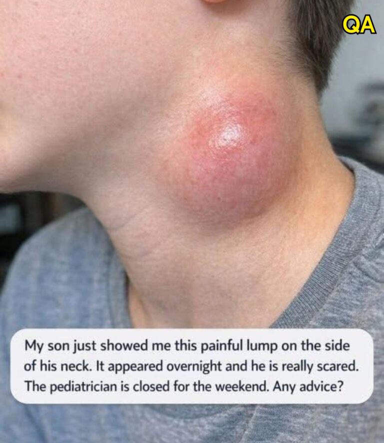 My son just showed me this painful lump on the side of his neck. It appeared overnight and he is really scared. The pediatrician is closed for the wee.