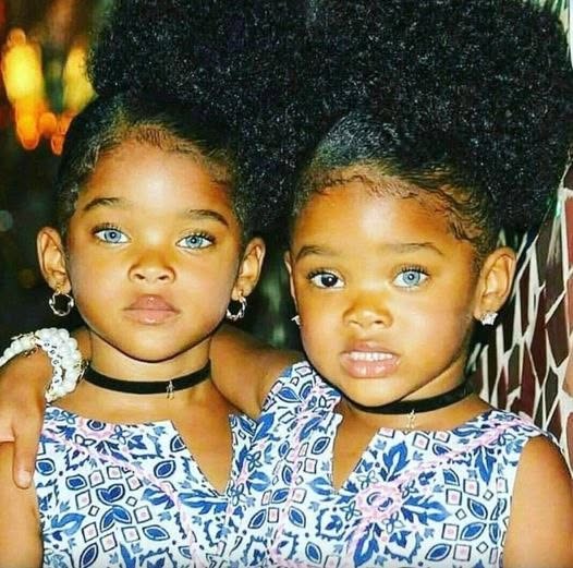 The “Blue Twins” who once captured global attention and dominated headlines — here’s what they look like now…