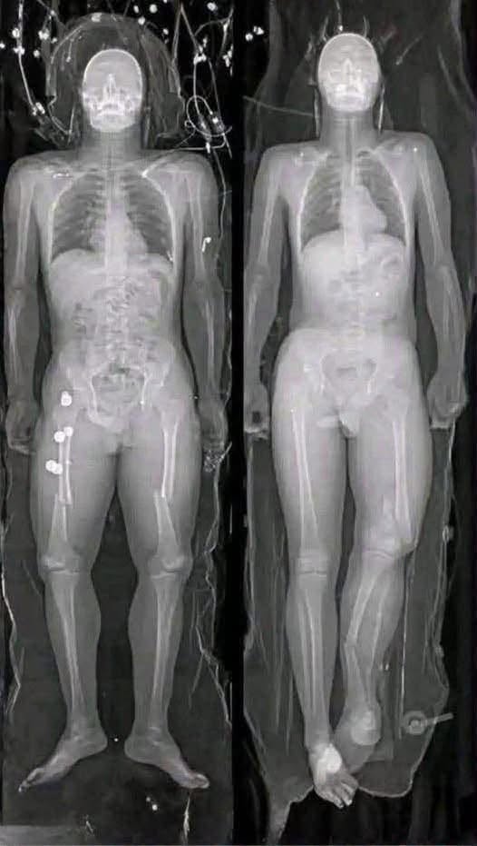 COVID-19 vaccinated individuals may be ill…See more..