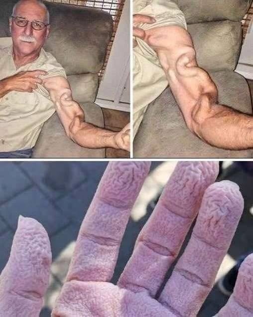Man Stretches His Arm — Doctors Say This Is What Actually Happened