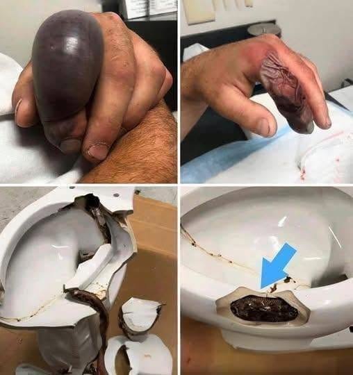 He Sat Down to Use the Bathroom — Then His Life Changed in Seconds