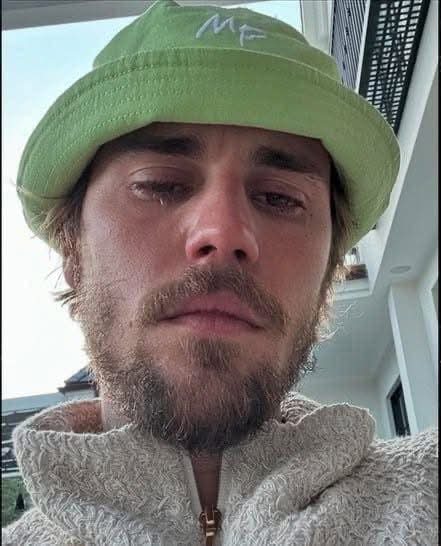 Justin Bieber admits that he tested positive for….see more
