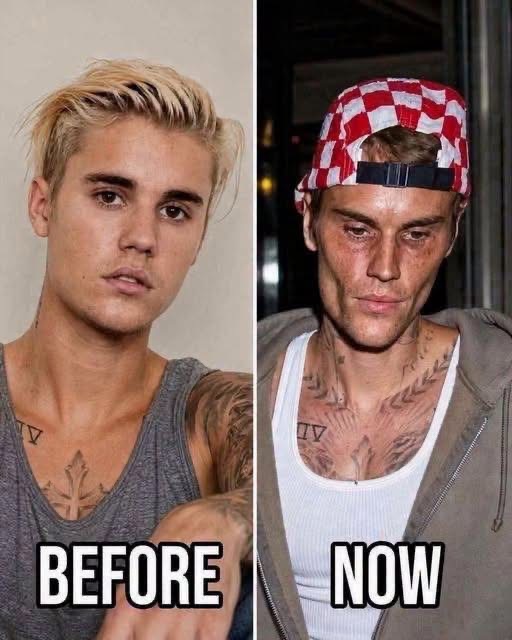 🥺Justin Bieber admits that he tested positive for…See more